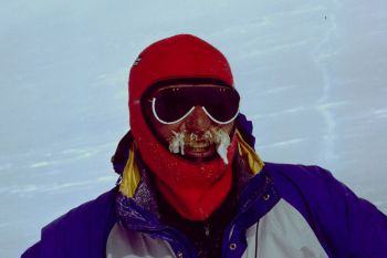 013-Alaska-2-Tour1987-Erfrierungen.jpg